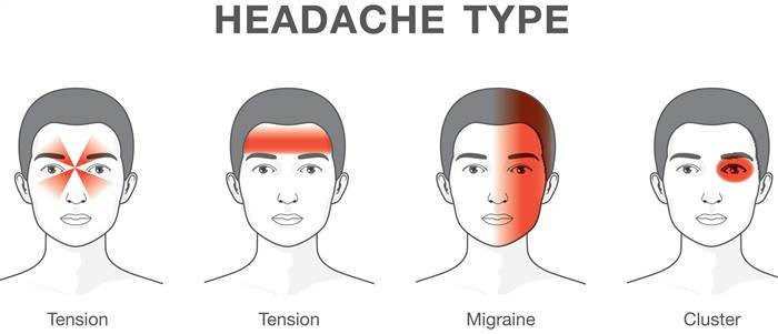 TENSION TYPE HEADACHE