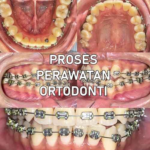 PASANG BEHEL