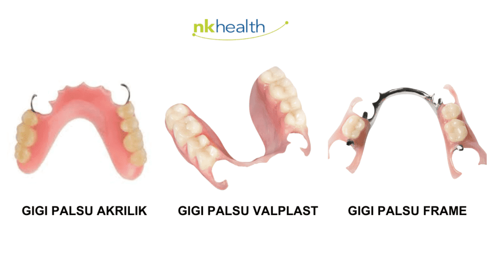 gigi palsu lepasan