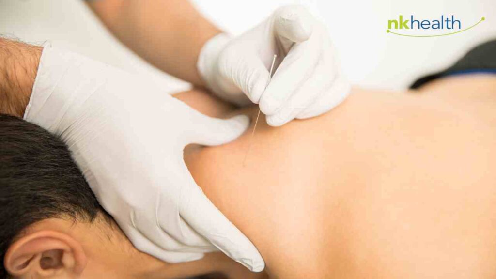 dry needling