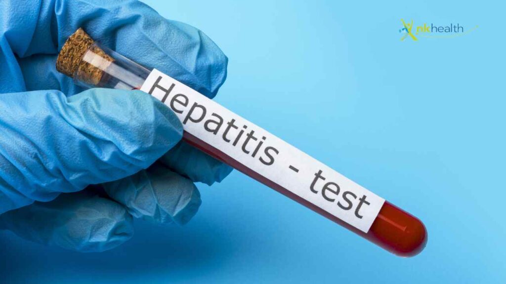 Perbedaan Hepatitis A dan B