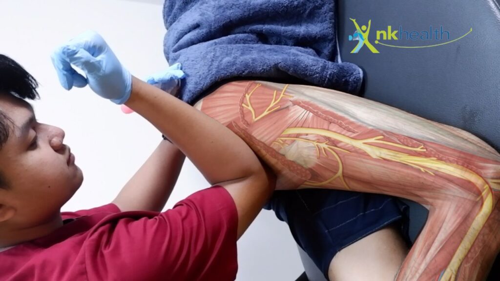 Saraf Sciatica